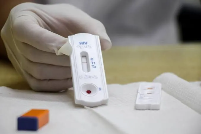 Teste de HIV. Foto: Imagem Ilustrativa/Reprodução -Internet