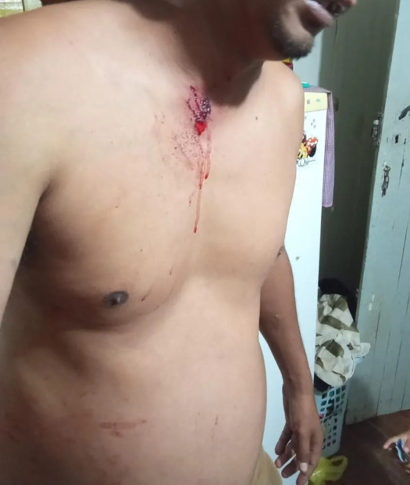 Lucas Araujo sofreu um ferimento próximo ao pescoço. Foto: Divulgação