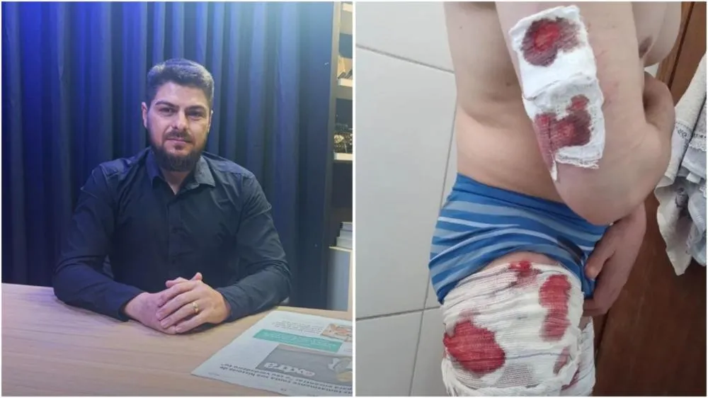 Ivan Barbosa ficou três semanas sem poder trabalhar, e hoje tem pesadelos com a cena. Foto: Divulgação