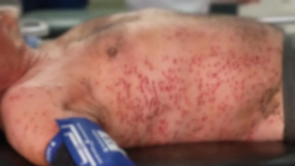  As vítimas foram atingidas por centenas de picadas e precisaram ser socorridas às pressas. Foto: Divulgação 